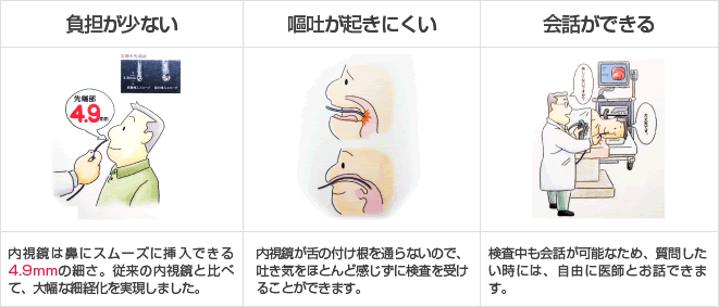 【負担が少ない】内視鏡は鼻にスムーズに挿入できる4.9mmの細さ。従来の内視鏡と比べて、大幅な細経化を実現しました。【嘔吐が起きにくい】内視鏡が舌の付け根を通らないので、吐き気をほとんど感じずに検査を受けることができます。【会話ができる】検査中も会話が可能なため、質問したい時には、自由に医師とお話できます。