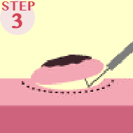 フック状のナイフで剥離面を削ぎ取る