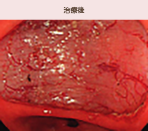 治療後